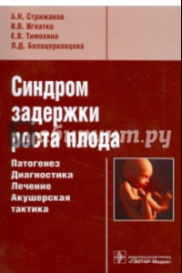 Книга Синдром задержки роста плода. Патогенез. Диагностика. Лечение. Акушерская тактика