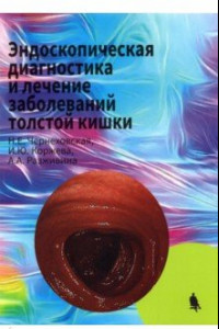 Книга Эндоскопическая диагностика и лечение заболеваний толстой кишки