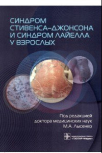 Книга Синдром Стивенса-Джонсона и синдром Лайелла у взрослых