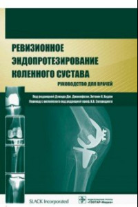 Книга Ревизионное эндопротезирование коленного сустава. Руководство для врачей