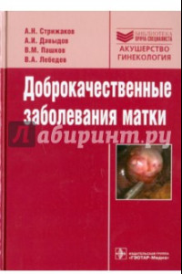 Книга Доброкачественные заболевания матки