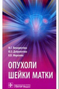 Книга Опухоли шейки матки