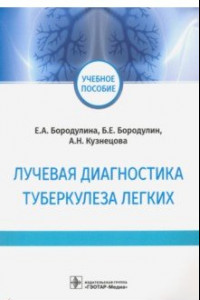 Книга Лучевая диагностика туберкулеза легких. Учебное пособие