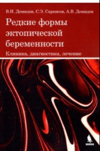 Книга Редкие формы эктопической беременности. Клиника, диагностика, лечение