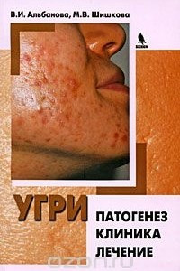 Книга Угри. Патогенез. Клиника. Лечение