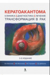 Книга Кератоакантома. Клиника, диагностика, лечение, трансформация в рак