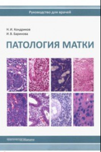 Книга Патология матки. Руководство для врачей