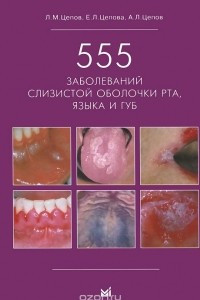 Книга 555 заболеваний слизистой оболочки рта, языка и губ