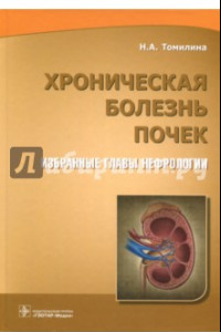 Книга Хроническая болезнь почек. Избранные главы нефрологии